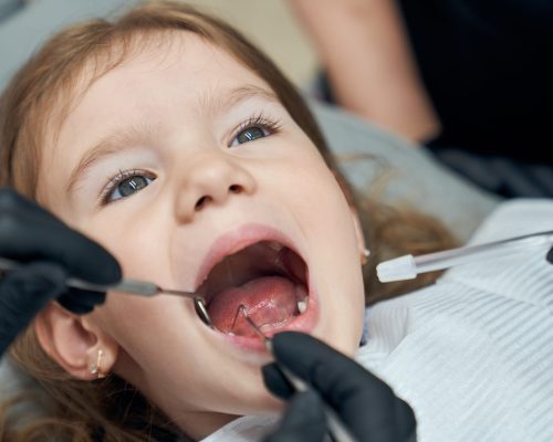Baby Tooth Extraction