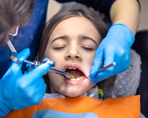 Girl in the dentist's office. Dentist examining child patient's teeth. High quality photo. Girl with open mouth at the dentist. Dentistry concept. Dental treatment at a specialist. SSUCv3H4sIAAAAAAAAA41Py47CMAz8F59TKaWFLfkVxCEPb7FIE5Q4oFWVf1+lFO11fRqP7ZnxCuRAQX/sD2ZE2TkjXdf3+N2Zs9Sd/RpHnIbJnqwDAU4zguqHYTocRzkN55PcSoDRmSyoFcj7kjlpphhASQEJg8O0QXTEMZH2oGQVkFlzyZhBrVWA1YxzTLT1H73L2nhQAAJyMQ1U8U/uKkDPGOxP068tiEe92V2uAu4vxrTs3pFvLWKDj0SWwrxnKpnj8sYhcrvdHDjaO7n9+P3GjTLH1LygPHzUDt0+LmYh5k+b8En4+tuutf4C1kPvx4QBAAA=